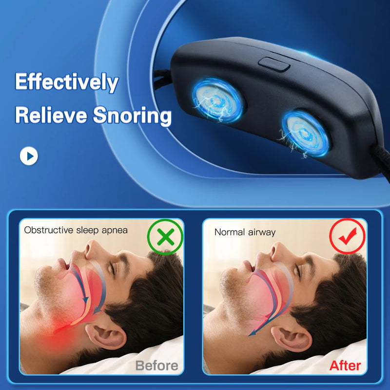 EMS Pulse Anti-Snoring Device | USB Rechargeable Sleep Apnea Aid | Smart Anti Snore Solution