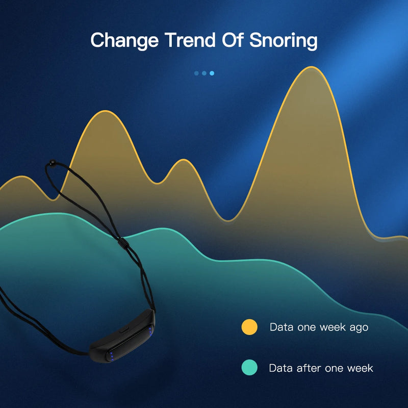 EMS Pulse Anti-Snoring Device | USB Rechargeable Sleep Apnea Aid | Smart Anti Snore Solution