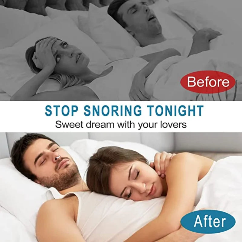 Anti-Snoring Magnetic Nose Clips – Silicone Sleep Aid for Easy Breathing & Apnea Relief