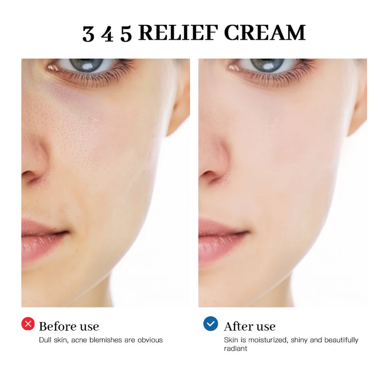 LAKERAIN345 Relief Cream – Moisturizing, Acne Treatment, Whitening, and Skin-Nourishing Solution